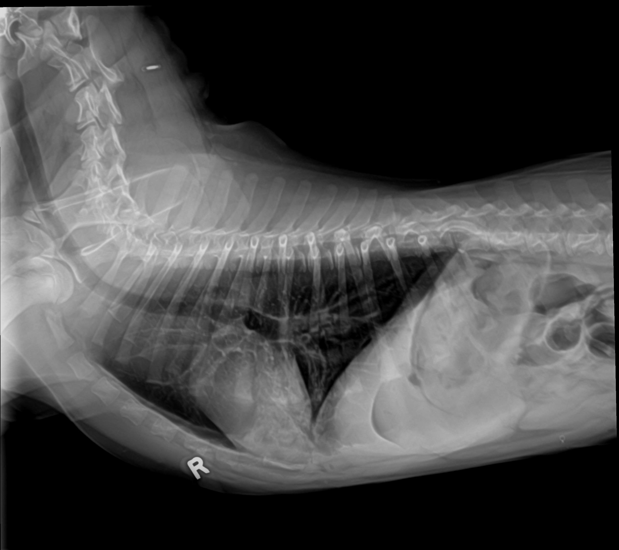Moe Thorax Radiograph Before Laser Therapy Lateral 2.5.26