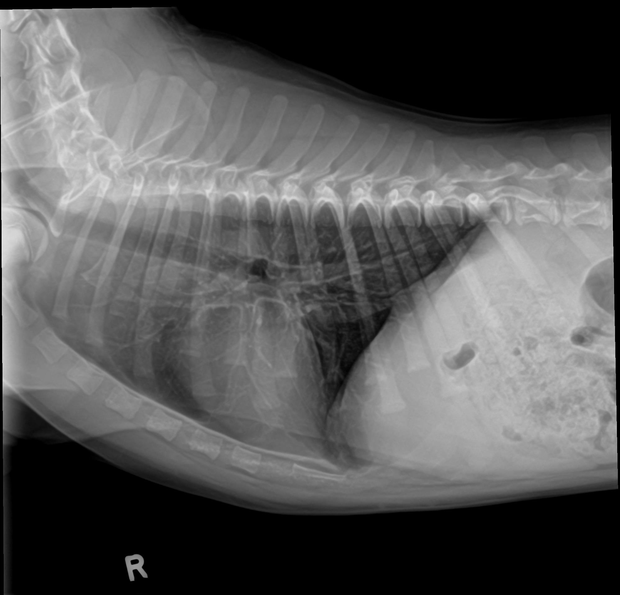 Moe Pneumonia Radiograph After Laser Therapy ThoraxRLat 2.10.26