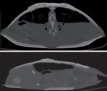 Severe Ulcerative Dermatitis in Aubrys Flapshell Turtle Sagittal and Transverse Computed Tomography Images of Penetrating Lesions and Bone Lysis 29 Months After Laser Therapy Treatment