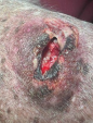 Cyst rupture on wheaton terrier day one after one treatment