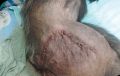 Chimpanzee with extensive skin wound after surgical repair