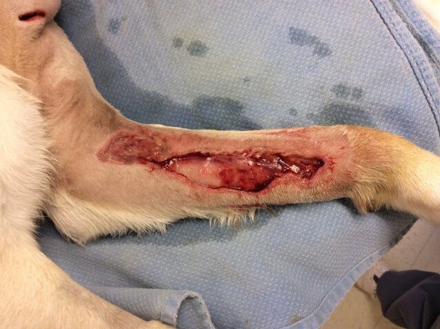 Post-six treatments for laser therapy after surgical debridement on necrotizing wound